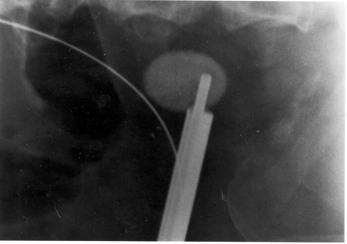 20 Abogados comparten las peticiones más sorprendentes que han visto en testamentos