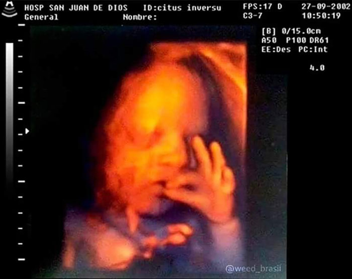 Kids-In-Predicaments