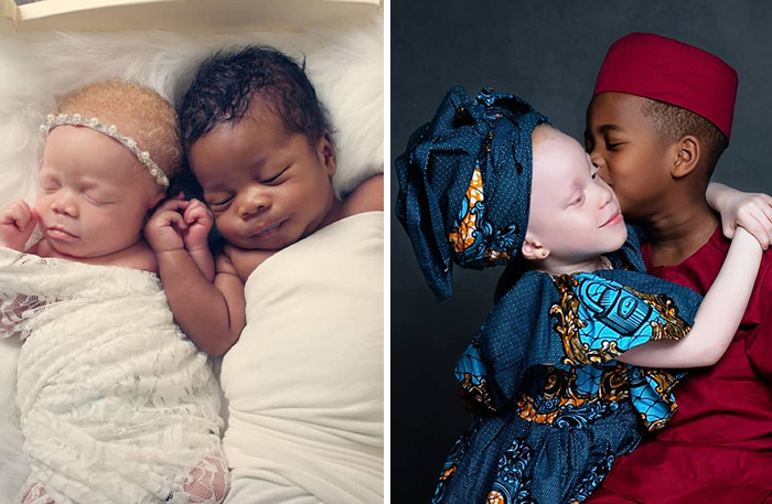 Woman Gave Birth To Black And White Twins, Thought She Was Handed The Wrong Baby