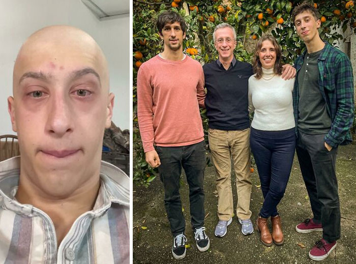 Me Dying Of Cancer Over The Spring vs. Me Happy And Healthy Spending Christmas With My Beautiful Family