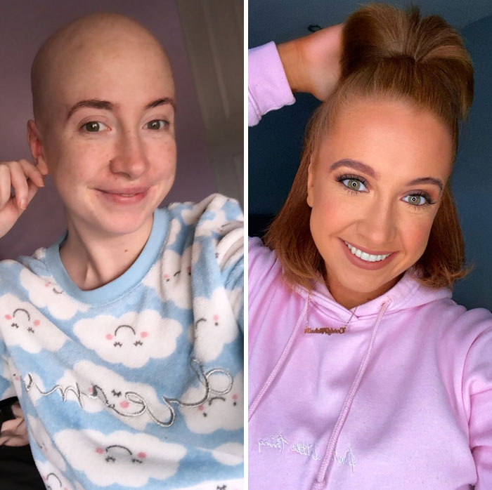 Today I’m One Year Cancer Free