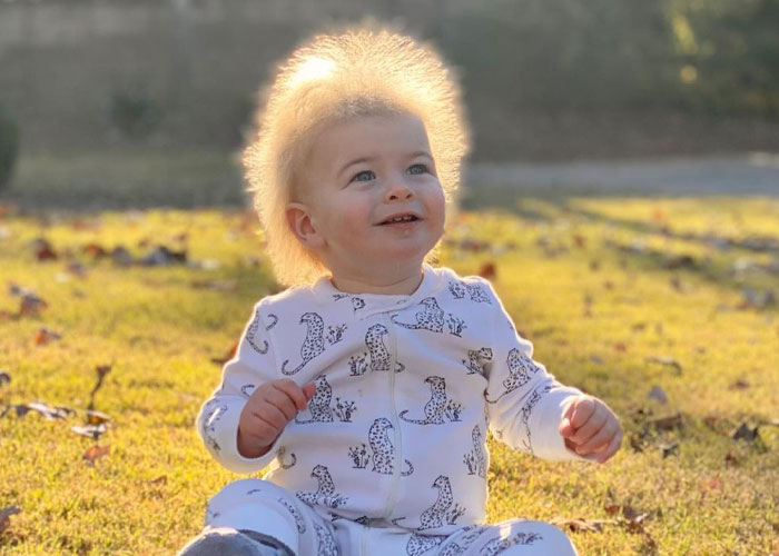 Happy Toddler Diagnosed With Uncombable Hair Syndrome Shows There Is No Such Thing As A Bad Hair Day