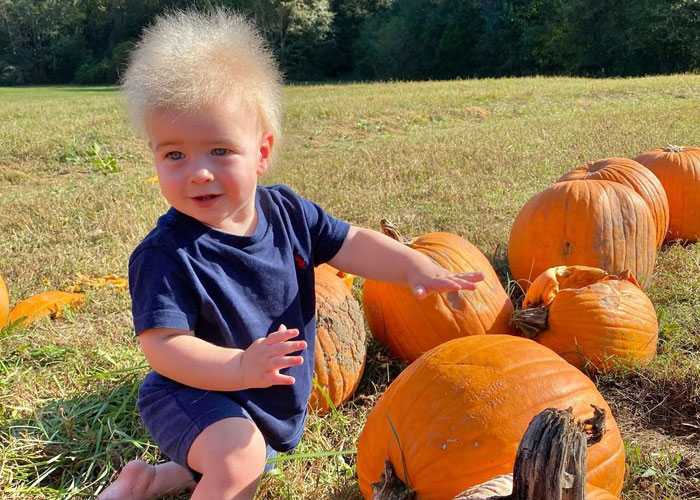 Happy Toddler Diagnosed With Uncombable Hair Syndrome Shows There Is No Such Thing As A Bad Hair Day
