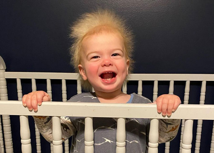 Happy Toddler Diagnosed With Uncombable Hair Syndrome Shows There Is No Such Thing As A Bad Hair Day