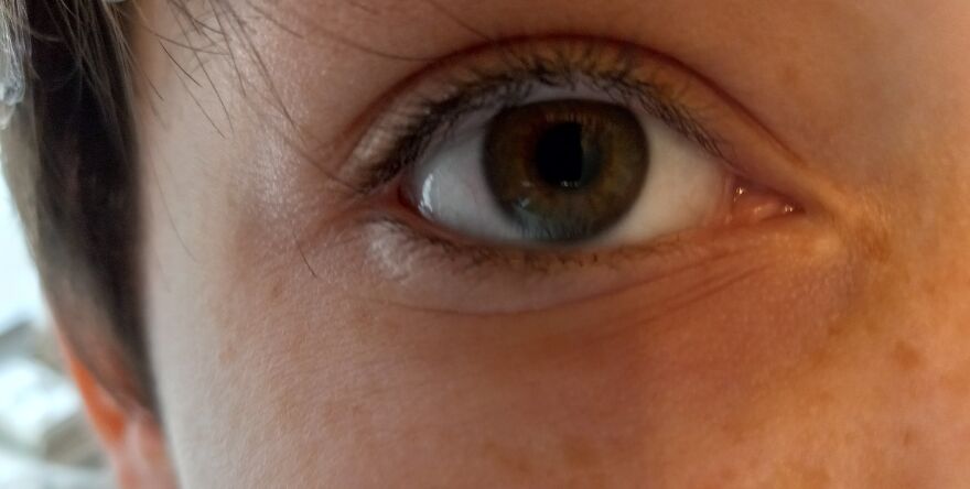 My Eyes Are Hazel :) I Think They Go Well With My Freckles