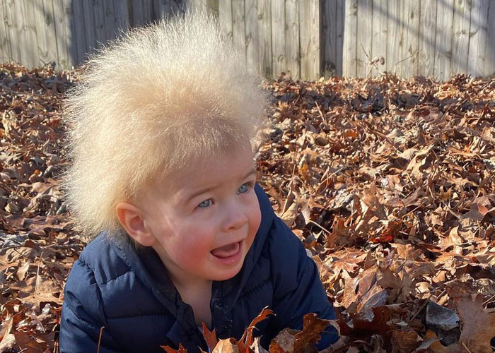 Happy Toddler Diagnosed With Uncombable Hair Syndrome Shows There Is No Such Thing As A Bad Hair Day