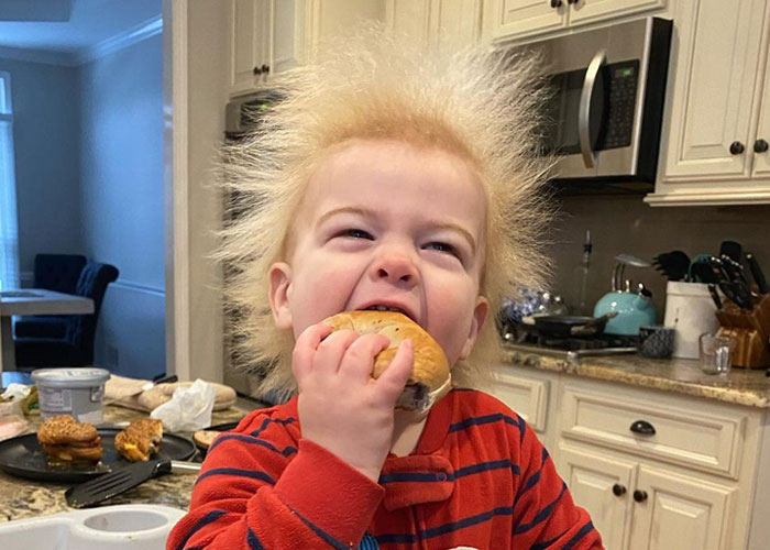 Happy Toddler Diagnosed With Uncombable Hair Syndrome Shows There Is No Such Thing As A Bad Hair Day