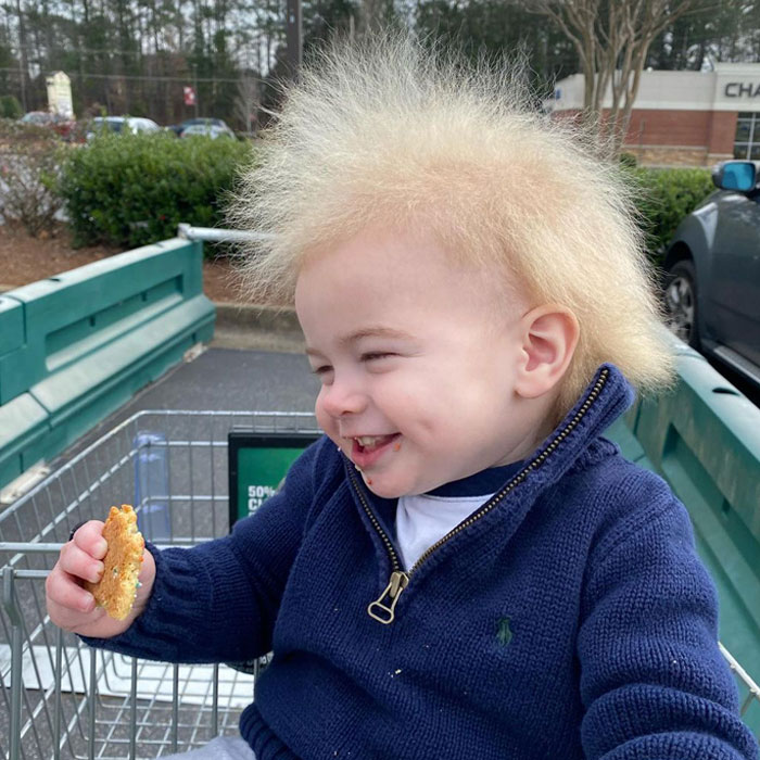 Happy Toddler Diagnosed With Uncombable Hair Syndrome Shows There Is No Such Thing As A Bad Hair Day