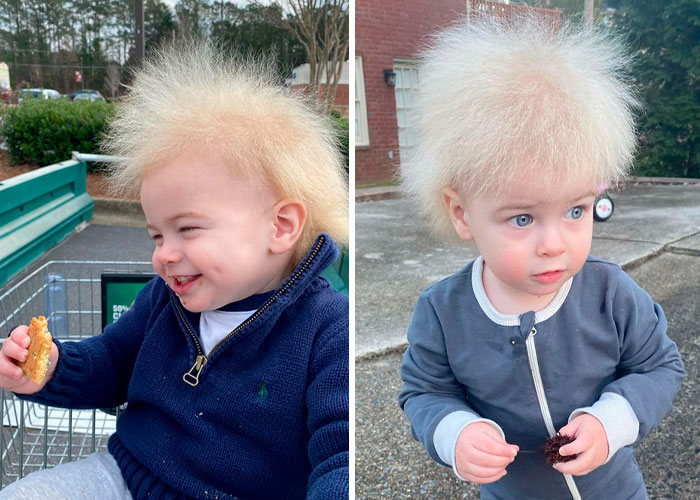 Happy Toddler Diagnosed With Uncombable Hair Syndrome Shows There Is No Such Thing As A Bad Hair Day