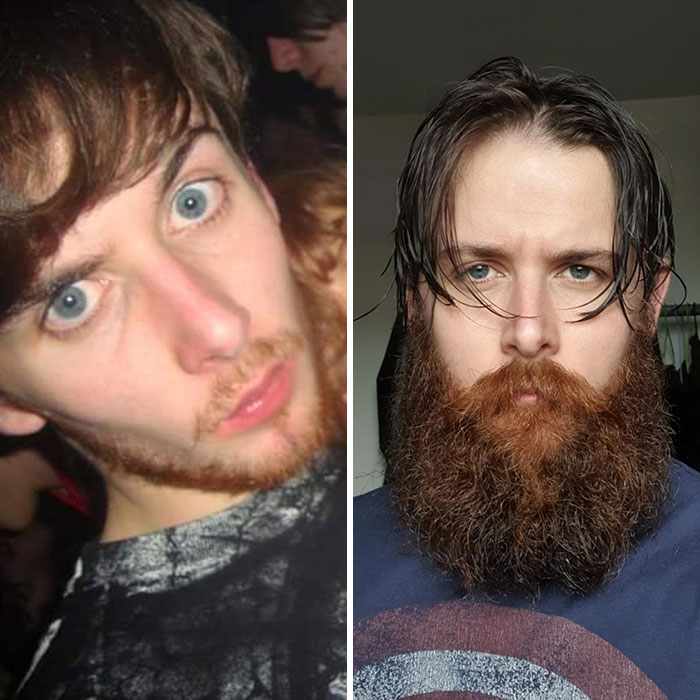 18 Year Olds - Don't Worry If You Can't Grow Much, Just Wait 10 Years