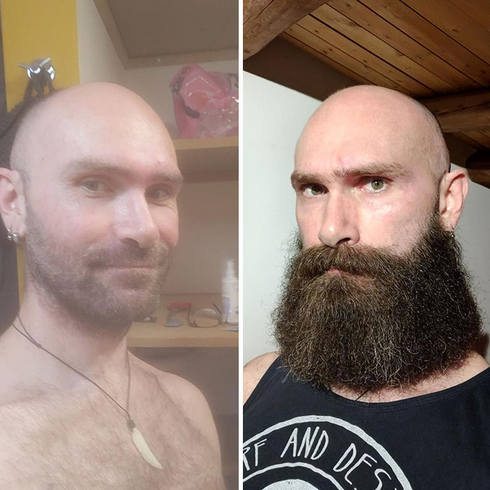 6 Months After