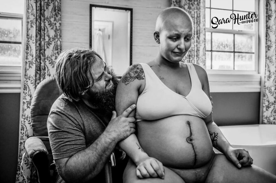 Best In Labor: "Ovarian Cancer Survivor - Hospital Transfer" By Sara Hunter, United States