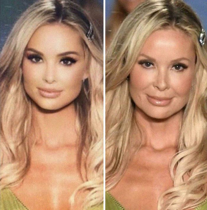 Lo que publicó la modelo vs. el fotógrafo de Getty