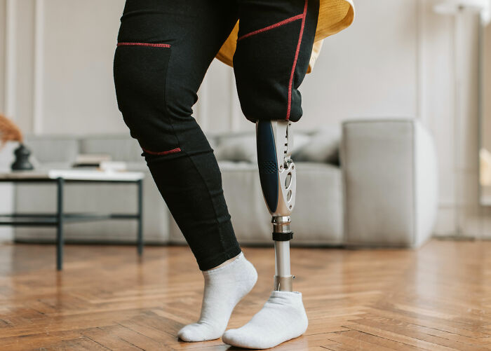 “I Took My Leg Off”: Woman Asks If She Was Wrong To Dramatically Respond To This Man Who Yelled At Her For Parking In A Handicapped Spot “I Took My Leg Off”: Woman Asks If She Was Wrong To Dramatically Respond To This Man Who Yelled At Her For Parking In A Handicapped Spot