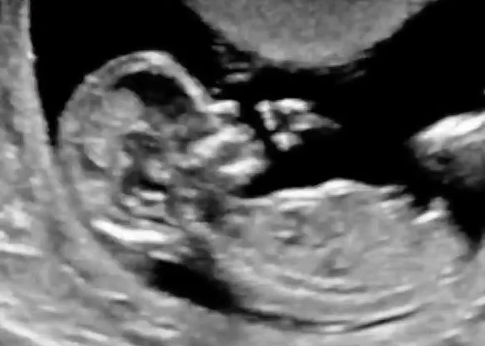 Pregnancy Takes 9 Months But This Man Waited 3 Years To Become A Single Father Through Surrogacy Pregnancy Takes 9 Months But This Man Waited 3 Years To Become A Single Father Through Surrogacy