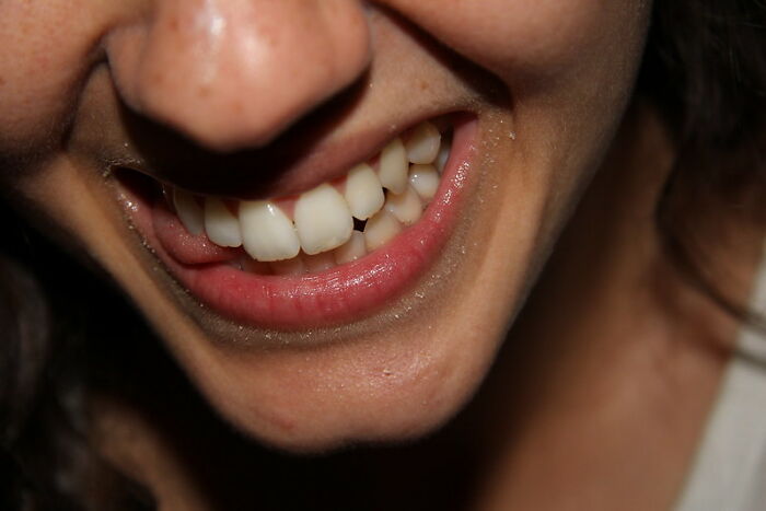 40 Expensive Things Whose High Price Tags Don't Make Any Sense At All, As Shared By Folks In This Online Group