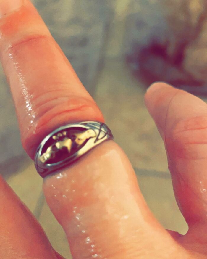 Expecting Moms Listen Up! Do Not Forget To Remove Your Rings Before Your 3rd Trimester