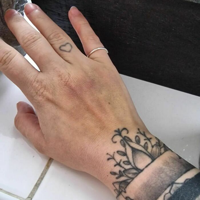 My Body Has Changed, My Mentality Has Changed And It's So Incredible. The Bruises Are Only A Glimpse Into The Trauma That A Woman's Body Goes Through During Childbirth