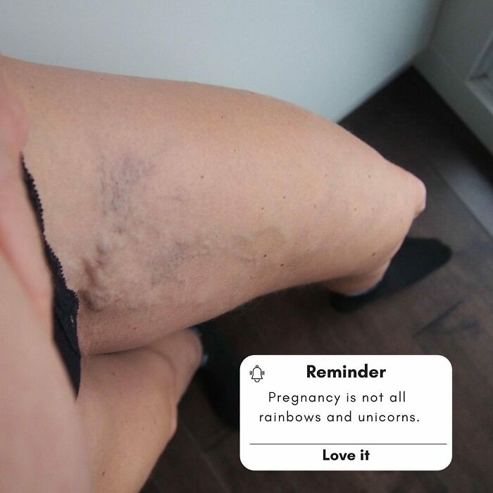 It Is Important To Share The Reality Of Pregnancy, Especially In This World Of Social Media Perfection