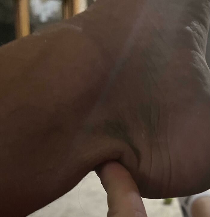 Took Time Between Sets To Help A Gym Employee Move A Squat Rack And Pop… Achilles Smoked