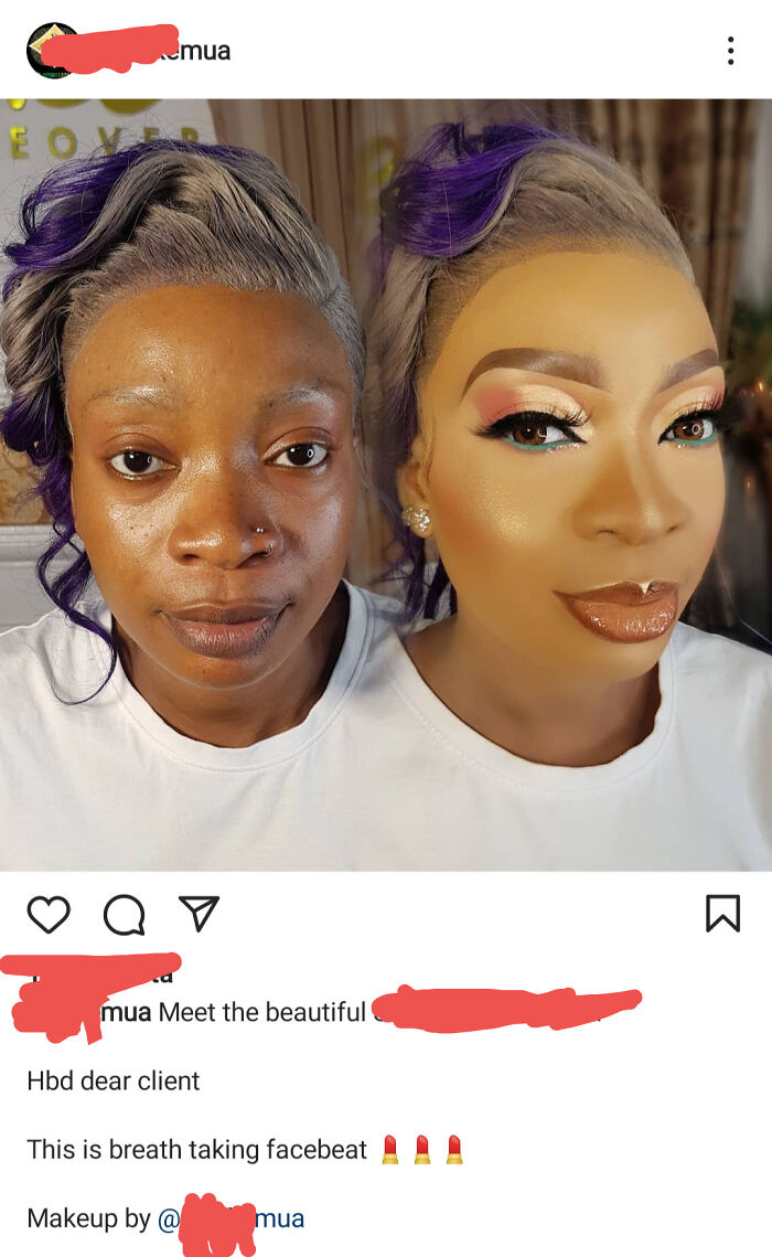 Her Skin Is So Beautiful 