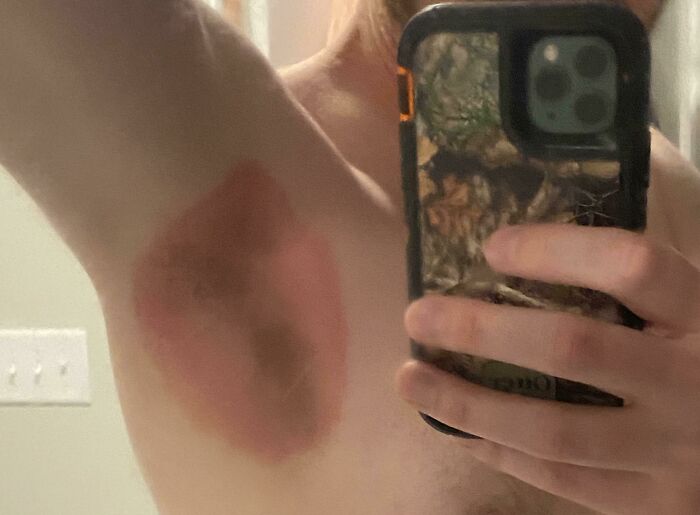 Found Out I’m Allergic To Old Spice