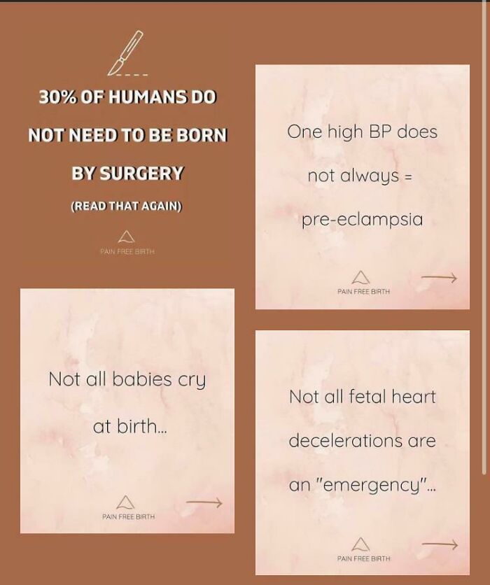 The Mother Of The 8mo Who Can’t Lift His Head Up Posted *this* In The Freebirth Group Back In January