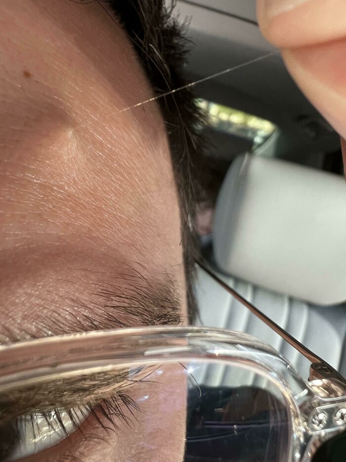 This 2-Inch Gray Hair Protruding From My Forehead