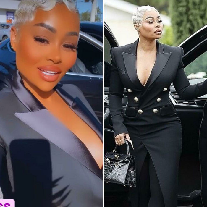 Obviously Heavy Filters In The Second Photo But Yikessss