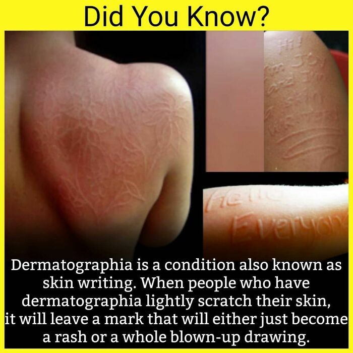 Follow @_.factopedia For More Amazing Facts And Reels