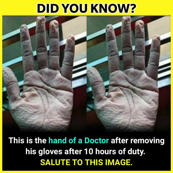 Wrinkled hand of a doctor after removing gloves following 10 hours of duty, illustrating dedication in unknown facts daily.