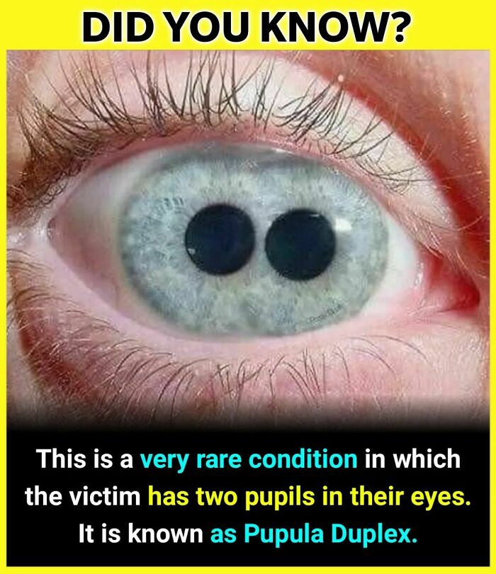 Your Thoughts⬇️
follow @_.factopedia For More Amazing Facts
#factsdaily #factsonly #factstho #factsoflife #facts💯 #didyouknowfacts #psychologyfacts #doyouknow #instafacts #unknownfacts #trendingfacts #sciencefacts #viralfacts #gkfacts #facts❗❗ #coolfacts #knowledge #realfacts #generalknowledge #factsonfacts #allfacts #fact #instafacts #facts💯💯💯 #factz #truefacts #dailyfacts