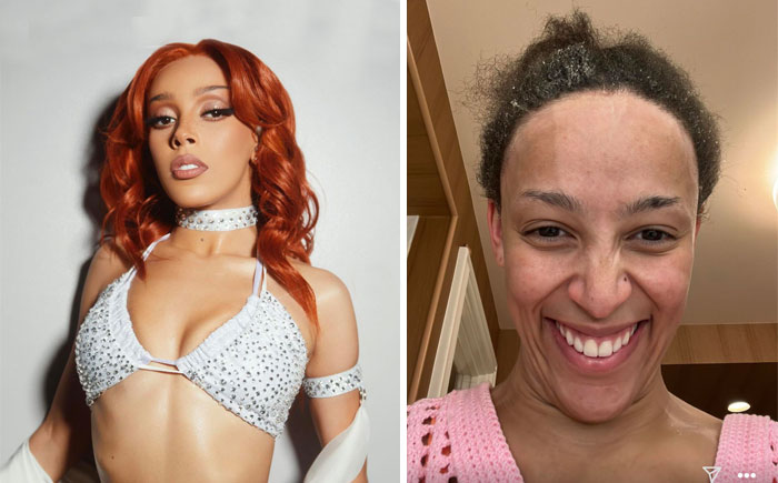 She’s The Best. These Are All Photos She Posted Herself Either On Her Story Or Ig Feed! She’s Beautiful, Confident And Silly