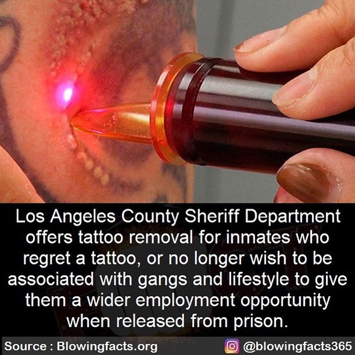 Laser tattoo removal on inmate's skin illustrating facts about tattoo removal and life changes shared on Instagram accounts.