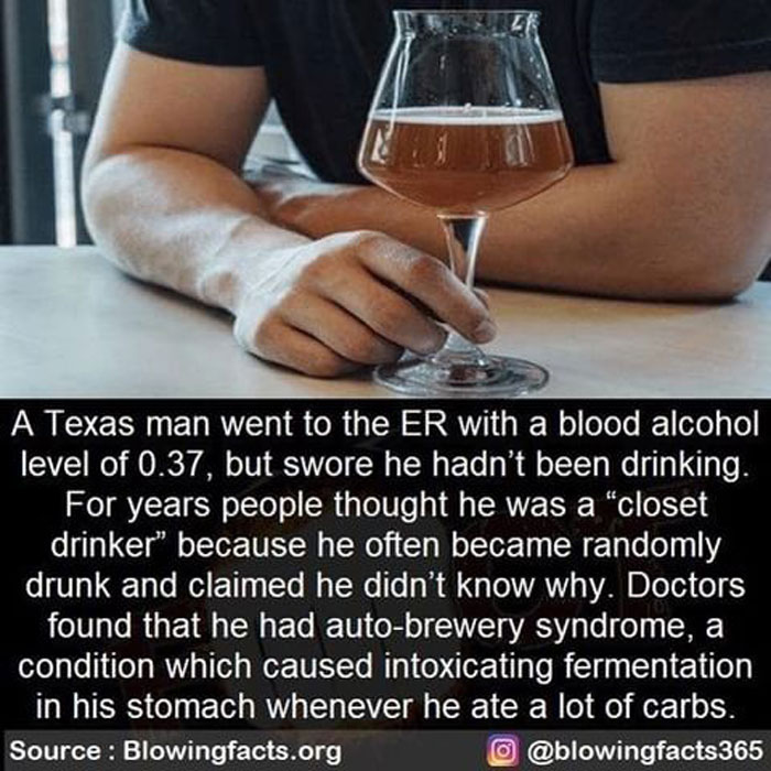 Auto-Brewery Syndrome