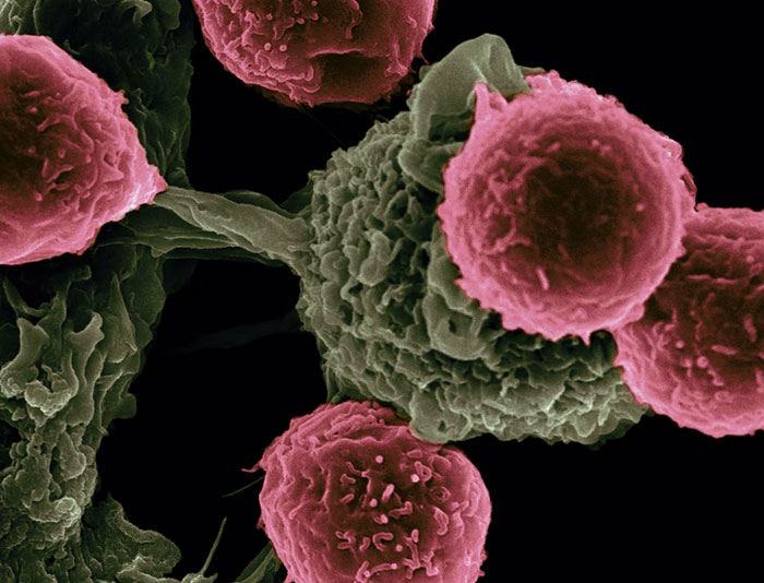 25 Personas delirantes que viven en su propio mundo