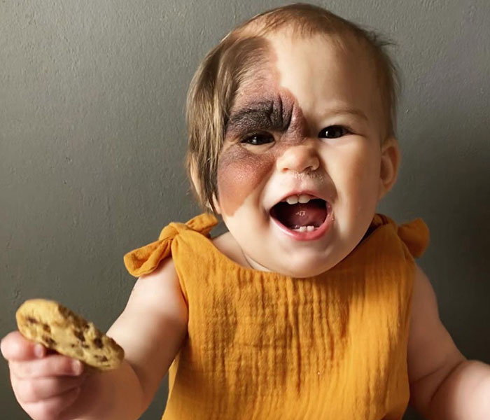 Mom Shares Her Daughter&rsquo;s Unique Birthmark, Gathering 300k Followers Supporting Their Journey