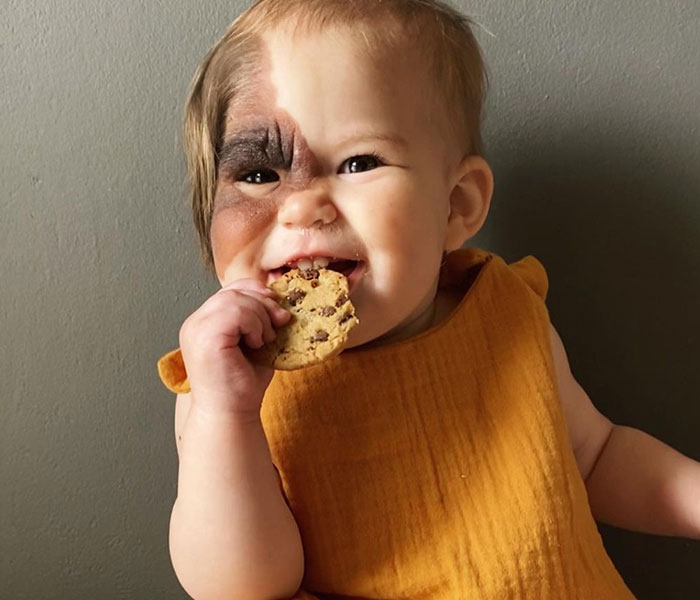 Mom Shares Her Daughter&rsquo;s Unique Birthmark, Gathering 300k Followers Supporting Their Journey