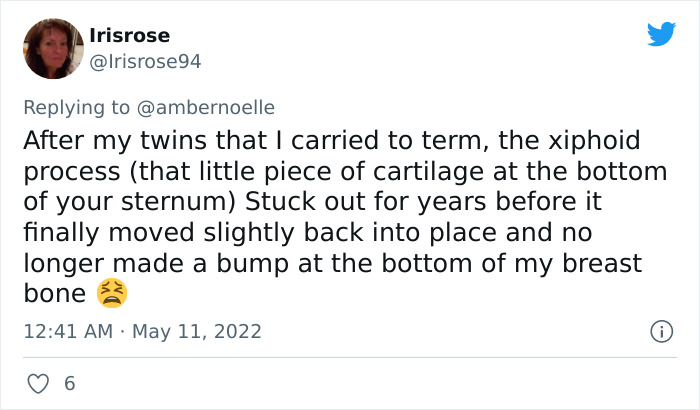 20 Ways Pregnancy Permanently Changed The Structure Of These Women&rsquo;s Bodies, As Shared On Twitter