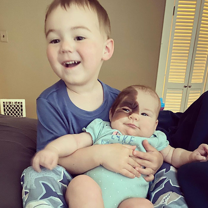 Mom Shares Her Daughter&rsquo;s Unique Birthmark, Gathering 300k Followers Supporting Their Journey