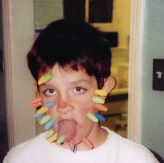 En el cuarto grado, me pegaba gomas de borrar por toda la cara, lo que me dejaba ronchas rojas por todas partes. Mi madre tuvo que enviarme a la escuela con una nota para que supieran que no tenía sarampión y que solo era un idiota