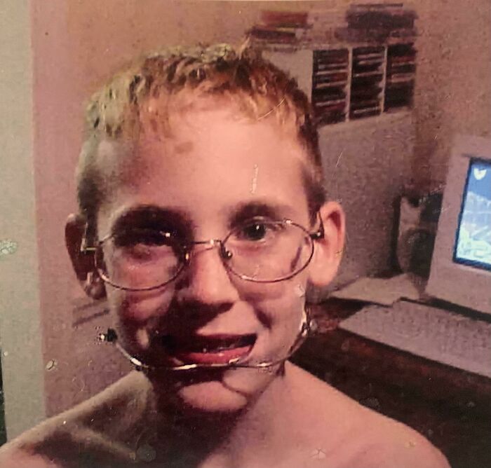 By Far The Worst Photo Of Me In Existence. 9 Years Old (1999)