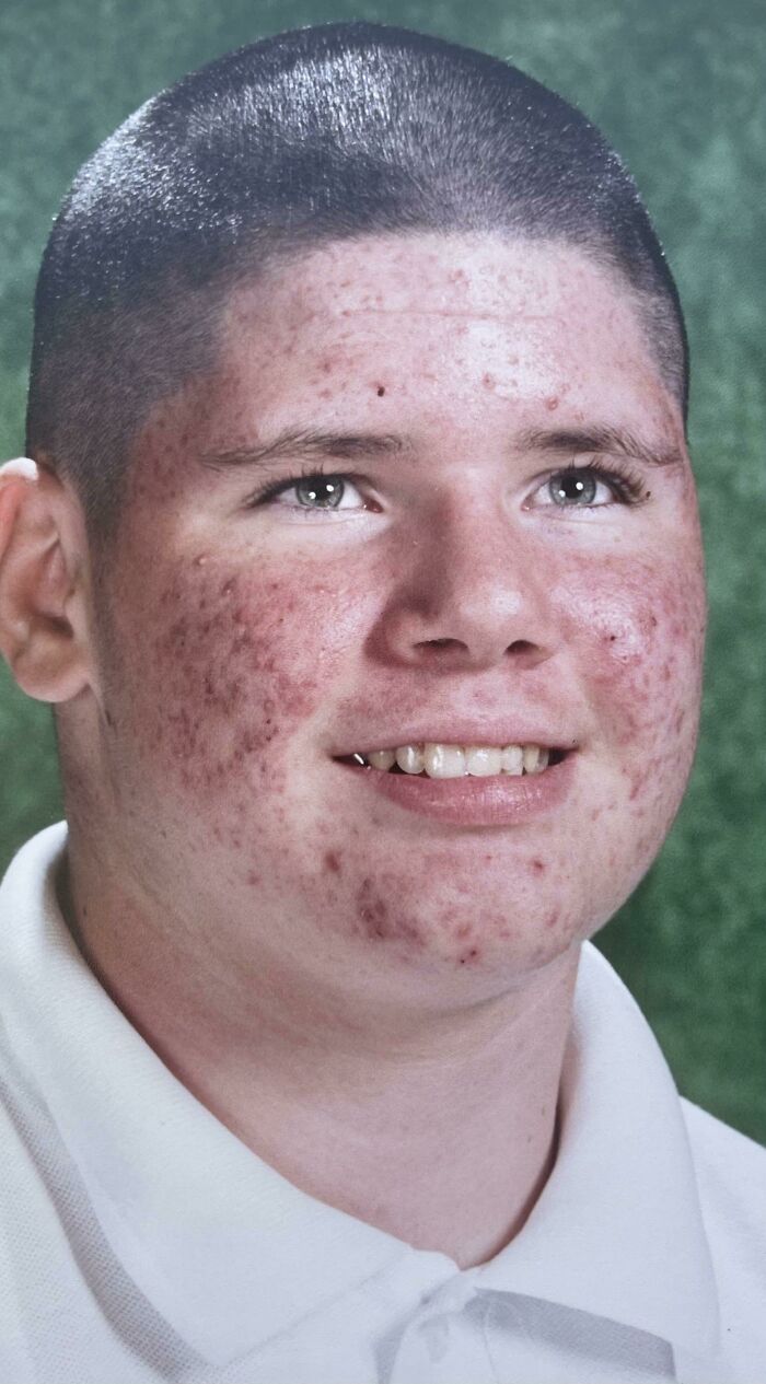 Puberty Hit Me Young. 5th Grade Photo