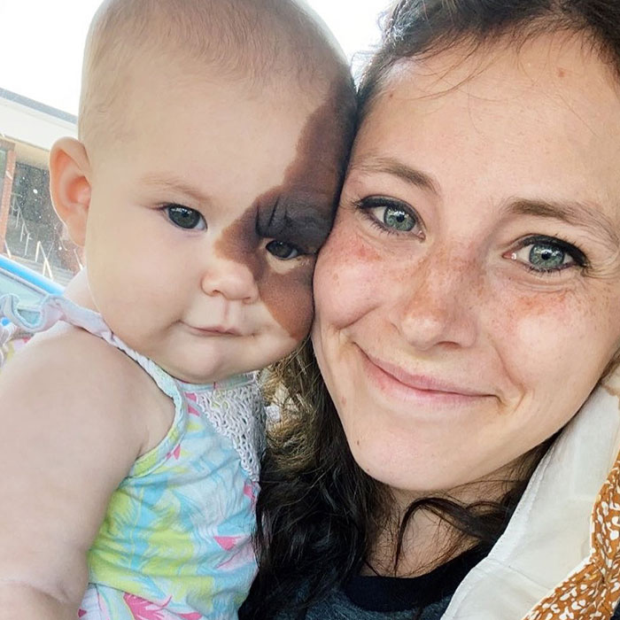 Mom Shares Her Daughter&rsquo;s Unique Birthmark, Gathering 300k Followers Supporting Their Journey