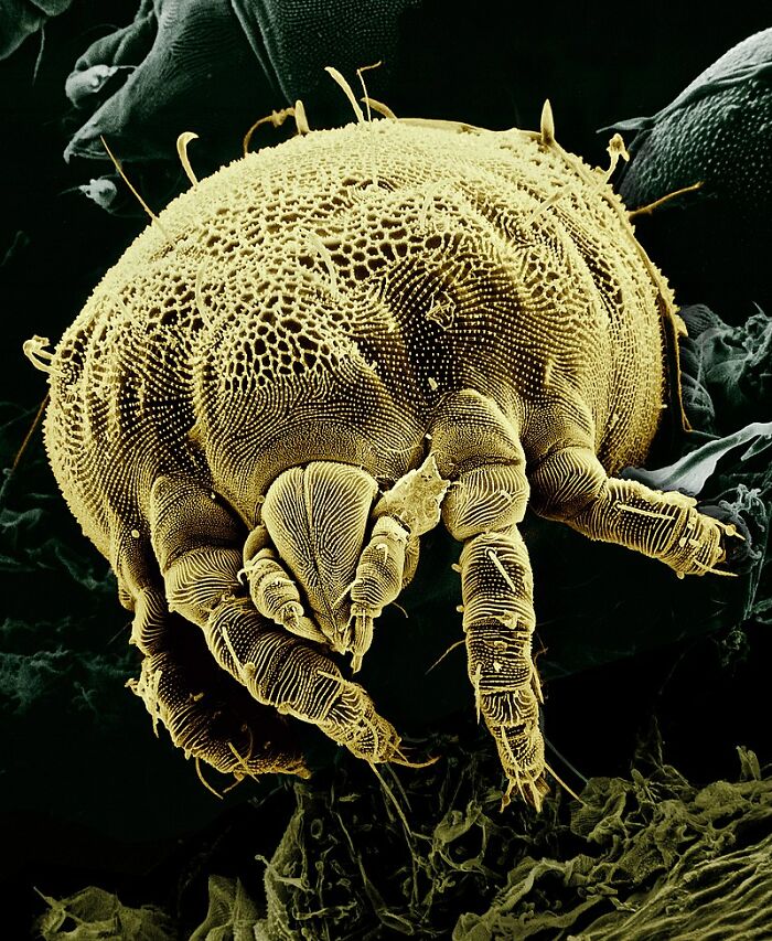 Close-up microscopic image of a mite on human skin, revealing disturbing details about human bodies that might freak you out.