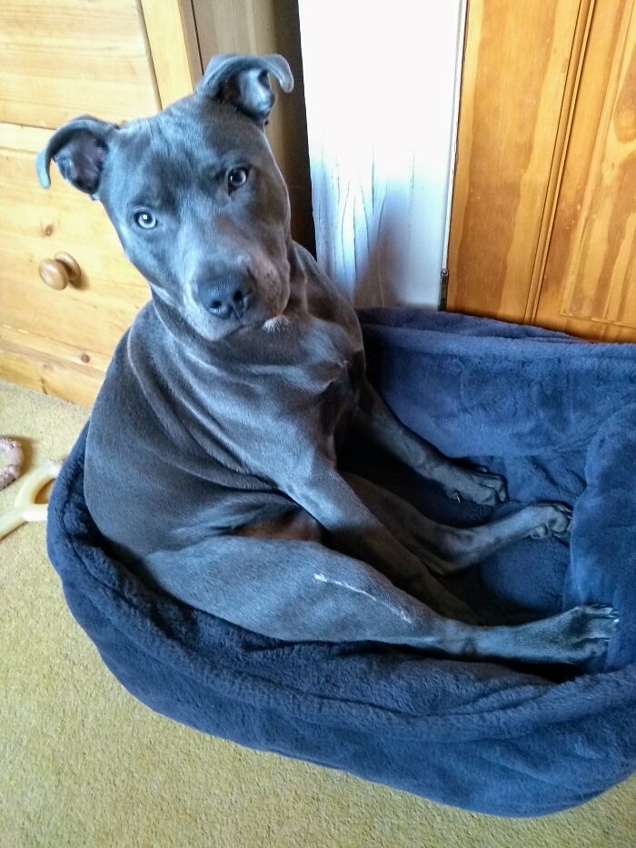 Ted ...4 Weeks After Leg Surgery ( Note The Scar!)