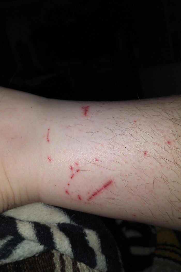 Anyone For A Snack Of Leg?