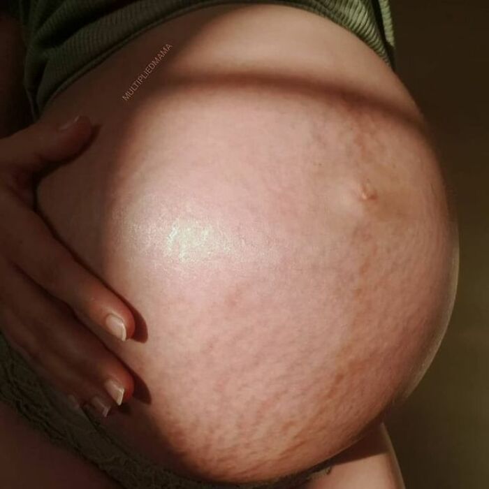 30 Mothers Are Sharing Realistic Pictures Of Baby Bumps And Pregnant Bodies To Fight Toxic Standards