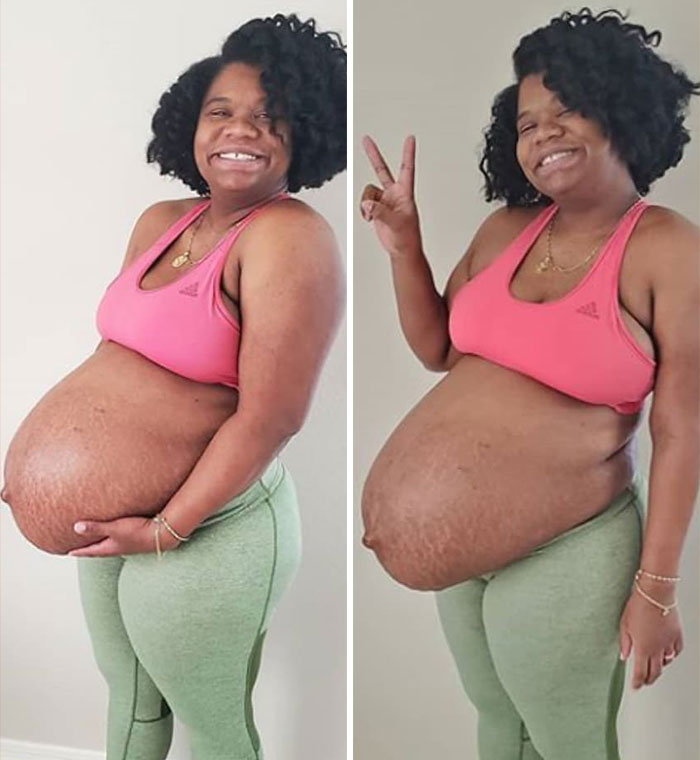 30 Mothers Are Sharing Realistic Pictures Of Baby Bumps And Pregnant Bodies To Fight Toxic Standards