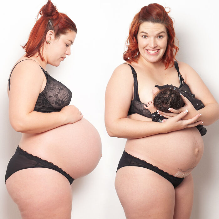 30 Mothers Are Sharing Realistic Pictures Of Baby Bumps And Pregnant Bodies To Fight Toxic Standards